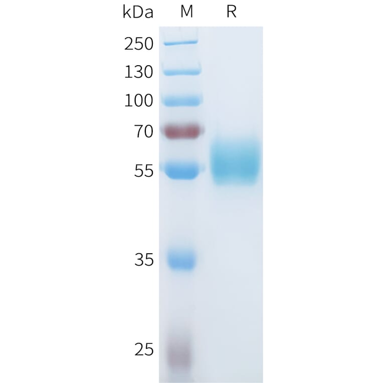 SDS-PAGE - Recombinant Human ROR1 Protein (C-terminal hFc Tag) (A332933) - Antibodies.com