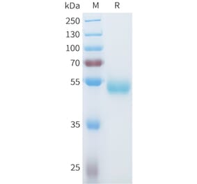 SDS-PAGE - Recombinant Human ROR1 Protein (C-terminal hFc Tag) (A332934) - Antibodies.com