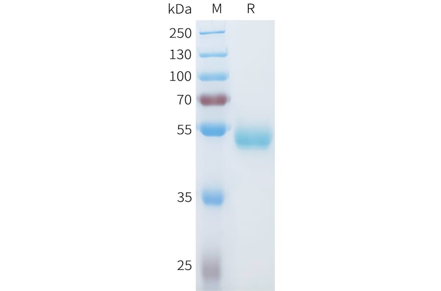 SDS-PAGE - Recombinant Human ROR1 Protein (C-terminal hFc Tag) (A332934) - Antibodies.com