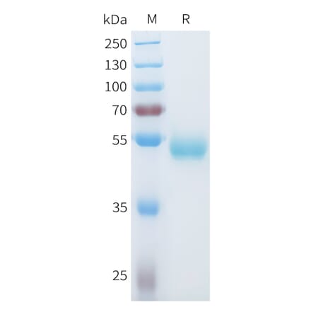 SDS-PAGE - Recombinant Human ROR1 Protein (C-terminal hFc Tag) (A332934) - Antibodies.com