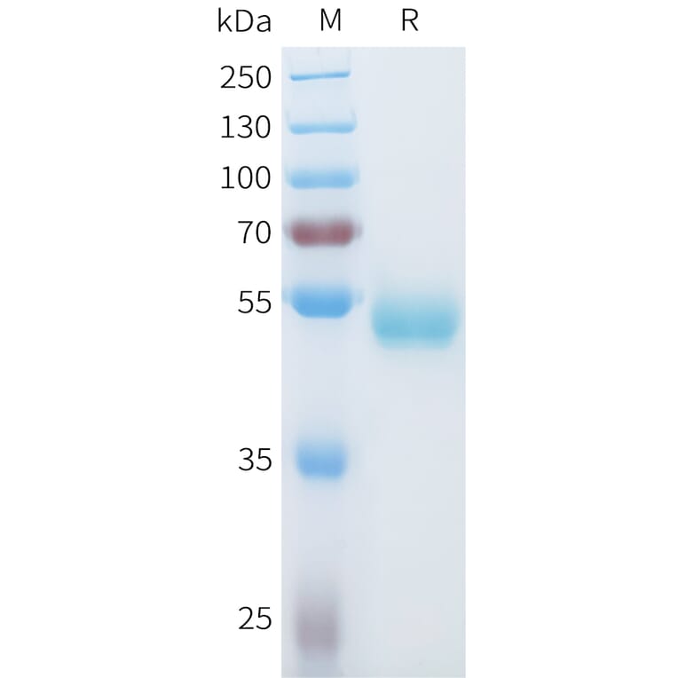 SDS-PAGE - Recombinant Human ROR1 Protein (C-terminal hFc Tag) (A332934) - Antibodies.com