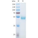 SDS-PAGE - Recombinant Human ROR1 Protein (C-terminal hFc Tag) (A332934) - Antibodies.com