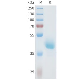 SDS-PAGE - Recombinant Human Axl Protein (C-terminal hFc Tag) (A332935) - Antibodies.com