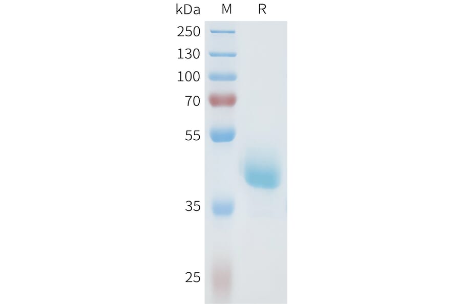 SDS-PAGE - Recombinant Human Axl Protein (C-terminal hFc Tag) (A332935) - Antibodies.com