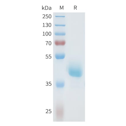 SDS-PAGE - Recombinant Human Axl Protein (C-terminal hFc Tag) (A332935) - Antibodies.com