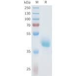 SDS-PAGE - Recombinant Human Axl Protein (C-terminal hFc Tag) (A332935) - Antibodies.com