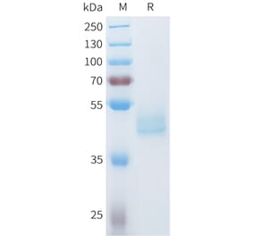 SDS-PAGE - Recombinant Human Axl Protein (C-terminal hFc Tag) (A332936) - Antibodies.com