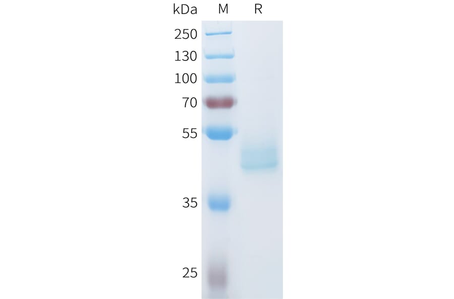SDS-PAGE - Recombinant Human Axl Protein (C-terminal hFc Tag) (A332936) - Antibodies.com