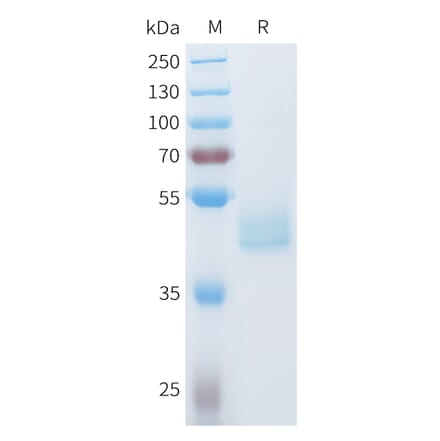 SDS-PAGE - Recombinant Human Axl Protein (C-terminal hFc Tag) (A332936) - Antibodies.com