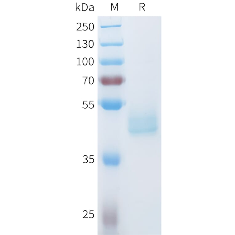 SDS-PAGE - Recombinant Human Axl Protein (C-terminal hFc Tag) (A332936) - Antibodies.com