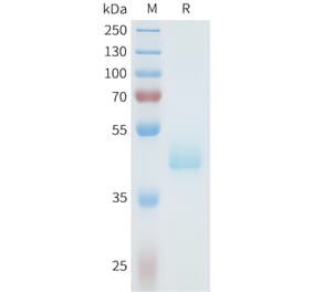 SDS-PAGE - Recombinant Human Axl Protein (C-terminal hFc Tag) (A332938) - Antibodies.com