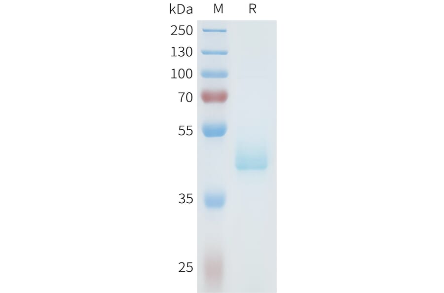 SDS-PAGE - Recombinant Human Axl Protein (C-terminal hFc Tag) (A332938) - Antibodies.com