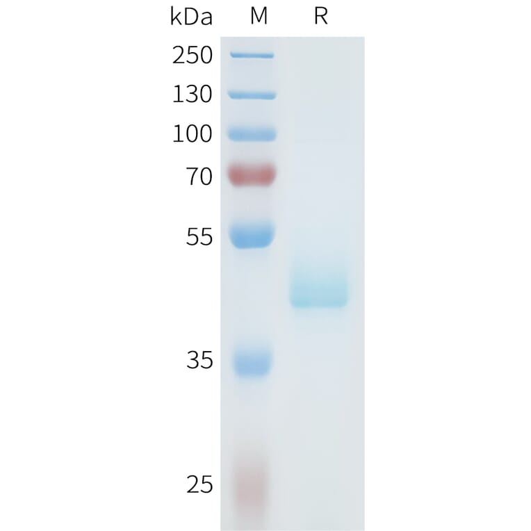 SDS-PAGE - Recombinant Human Axl Protein (C-terminal hFc Tag) (A332938) - Antibodies.com