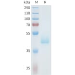 SDS-PAGE - Recombinant Human Axl Protein (C-terminal hFc Tag) (A332938) - Antibodies.com