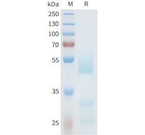 SDS-PAGE - Recombinant Human Axl Protein (C-terminal hFc Tag) (A332939) - Antibodies.com