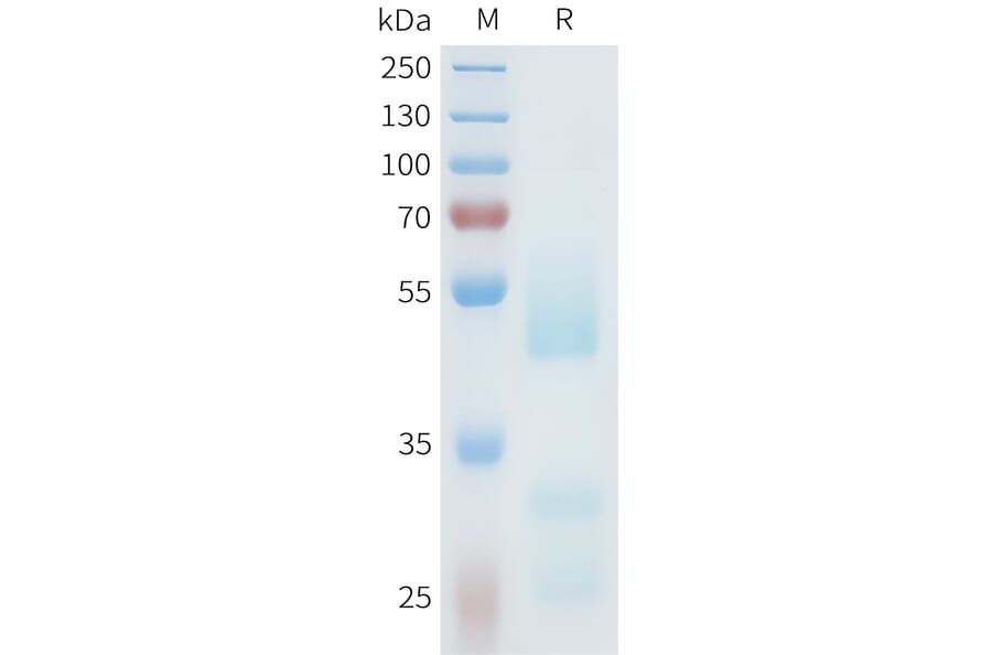 SDS-PAGE - Recombinant Human Axl Protein (C-terminal hFc Tag) (A332939) - Antibodies.com