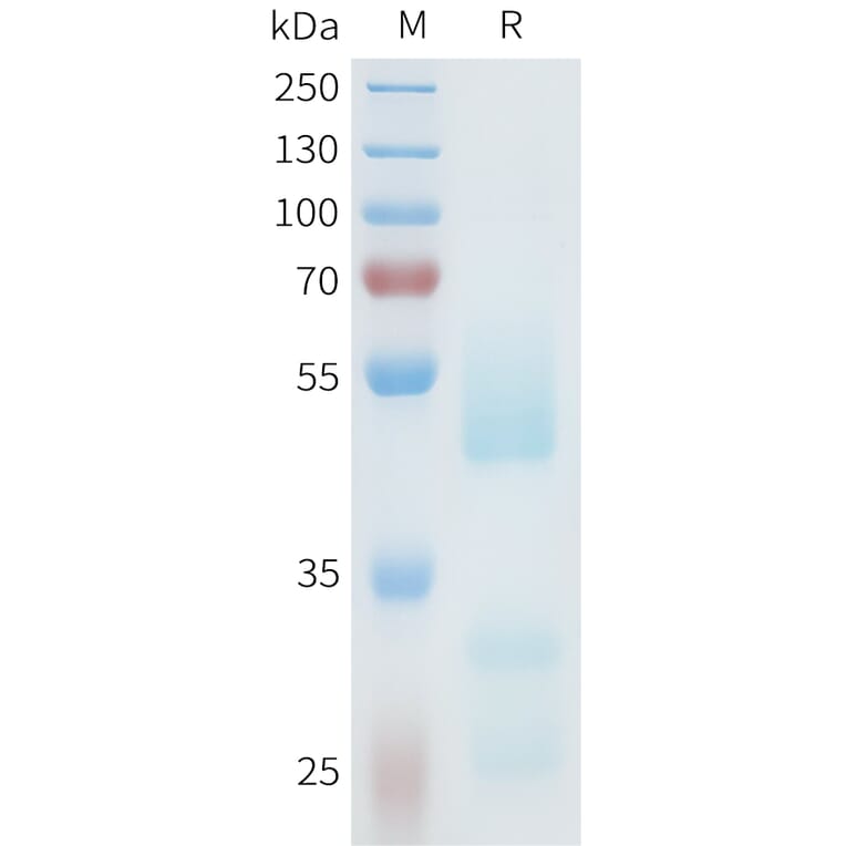 SDS-PAGE - Recombinant Human Axl Protein (C-terminal hFc Tag) (A332939) - Antibodies.com