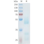 SDS-PAGE - Recombinant Human Axl Protein (C-terminal hFc Tag) (A332939) - Antibodies.com