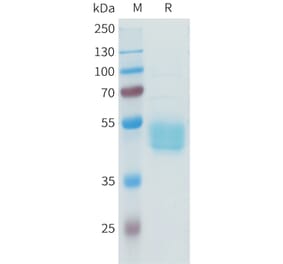 SDS-PAGE - Recombinant Human B7-H3 Protein (C-terminal hFc Tag) (A332941) - Antibodies.com