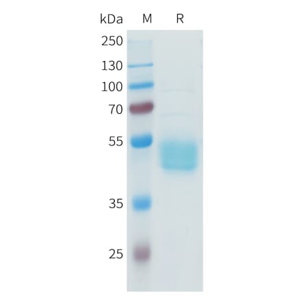 SDS-PAGE - Recombinant Human B7-H3 Protein (C-terminal hFc Tag) (A332941) - Antibodies.com