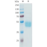 SDS-PAGE - Recombinant Human B7-H3 Protein (C-terminal hFc Tag) (A332941) - Antibodies.com