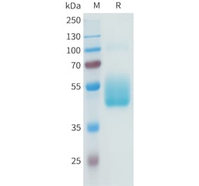 SDS-PAGE - Recombinant Human B7-H3 Protein (C-terminal hFc Tag) (A332942) - Antibodies.com