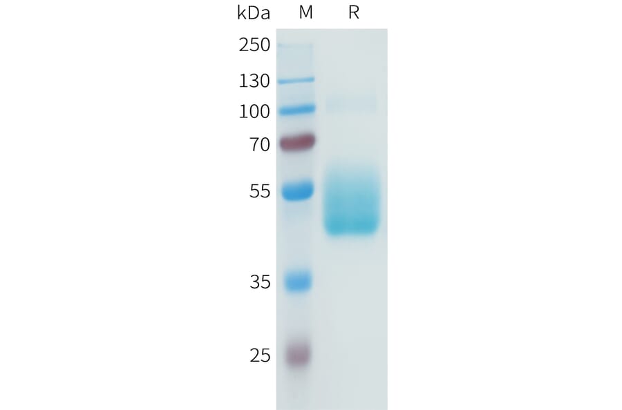 SDS-PAGE - Recombinant Human B7-H3 Protein (C-terminal hFc Tag) (A332942) - Antibodies.com