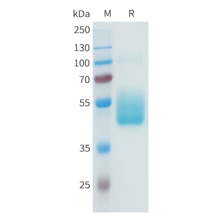 SDS-PAGE - Recombinant Human B7-H3 Protein (C-terminal hFc Tag) (A332942) - Antibodies.com