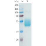 SDS-PAGE - Recombinant Human B7-H3 Protein (C-terminal hFc Tag) (A332942) - Antibodies.com