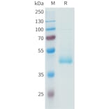 SDS-PAGE - Recombinant Human PD-L1 Protein (C-terminal hFc Tag) (A332943) - Antibodies.com