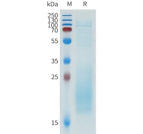 SDS-PAGE - Recombinant Human IL-31 Protein (C-terminal 10xHis Tag) (A332945) - Antibodies.com