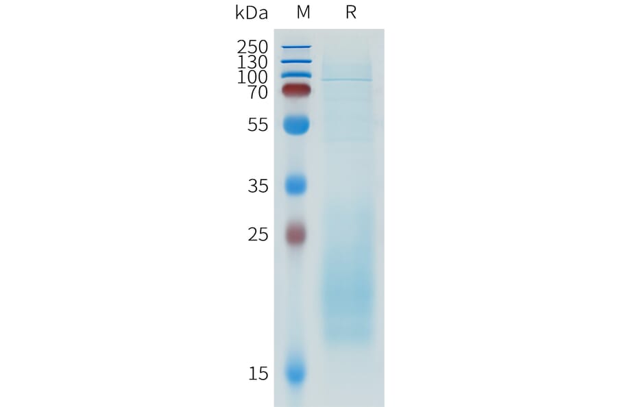 SDS-PAGE - Recombinant Human IL-31 Protein (C-terminal 10xHis Tag) (A332945) - Antibodies.com