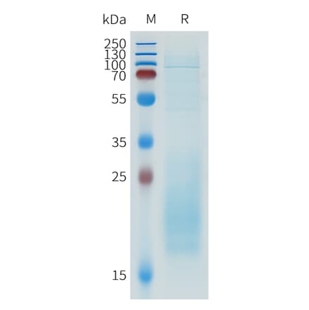 SDS-PAGE - Recombinant Human IL-31 Protein (C-terminal 10xHis Tag) (A332945) - Antibodies.com