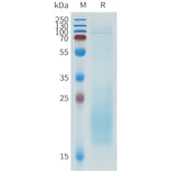 SDS-PAGE - Recombinant Human IL-31 Protein (C-terminal 10xHis Tag) (A332945) - Antibodies.com