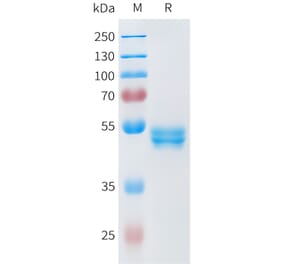 SDS-PAGE - Recombinant Human ROR2 Protein (C-terminal hFc Tag) (A332946) - Antibodies.com