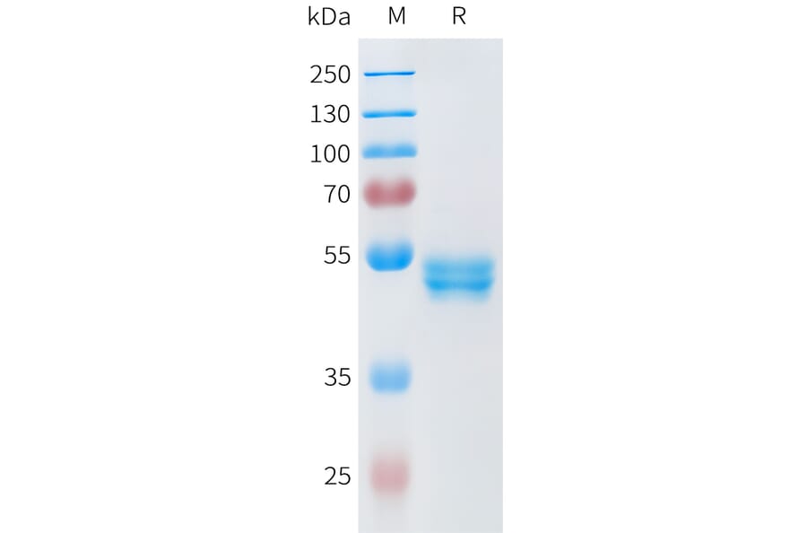 SDS-PAGE - Recombinant Human ROR2 Protein (C-terminal hFc Tag) (A332946) - Antibodies.com