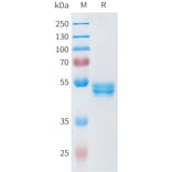 SDS-PAGE - Recombinant Human ROR2 Protein (C-terminal hFc Tag) (A332946) - Antibodies.com
