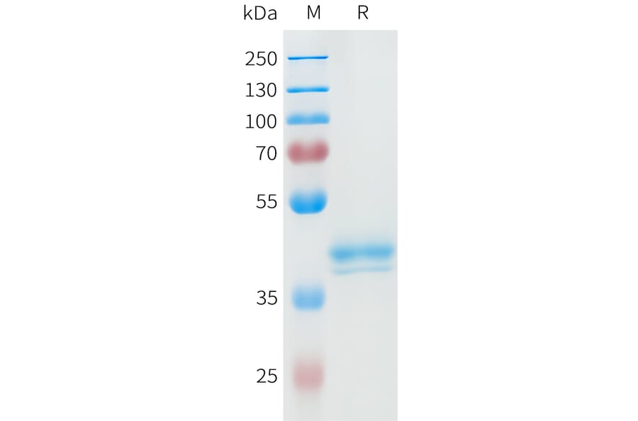 SDS-PAGE - Recombinant Human ROR2 Protein (C-terminal hFc Tag) (A332947) - Antibodies.com