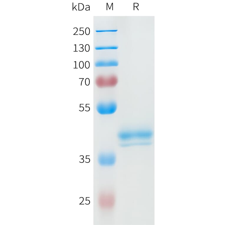 SDS-PAGE - Recombinant Human ROR2 Protein (C-terminal hFc Tag) (A332947) - Antibodies.com