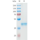 SDS-PAGE - Recombinant Human ROR2 Protein (C-terminal hFc Tag) (A332947) - Antibodies.com