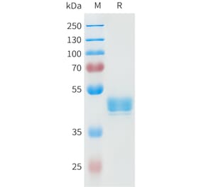 SDS-PAGE - Recombinant Human P-Cadherin Protein (C-terminal hFc Tag) (A332948) - Antibodies.com