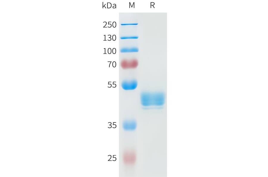 SDS-PAGE - Recombinant Human P-Cadherin Protein (C-terminal hFc Tag) (A332948) - Antibodies.com