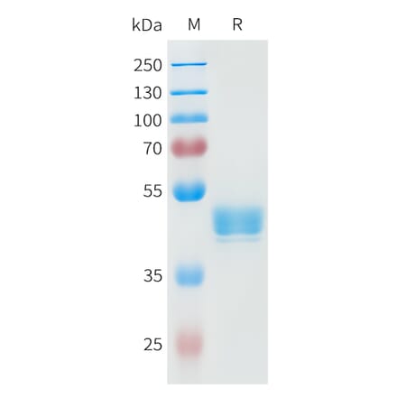 SDS-PAGE - Recombinant Human P-Cadherin Protein (C-terminal hFc Tag) (A332948) - Antibodies.com