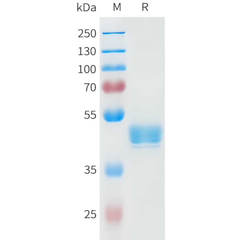 SDS-PAGE - Recombinant Human P-Cadherin Protein (C-terminal hFc Tag) (A332948) - Antibodies.com