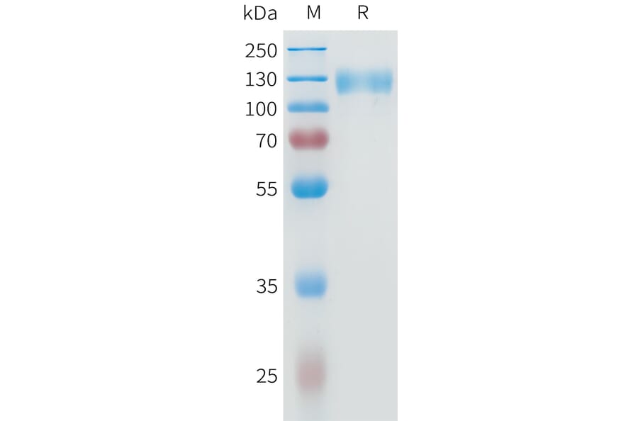 SDS-PAGE - Recombinant Human IL-31RA Protein (C-terminal hFc Tag) (A332949) - Antibodies.com