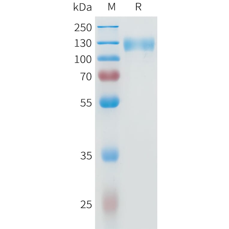 SDS-PAGE - Recombinant Human IL-31RA Protein (C-terminal hFc Tag) (A332949) - Antibodies.com