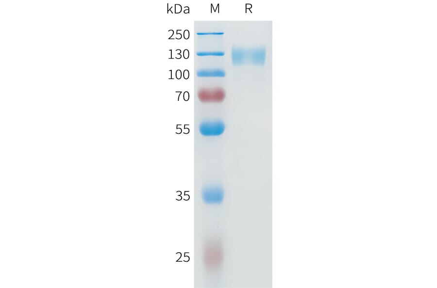 SDS-PAGE - Recombinant Human IL-31RA Protein (C-terminal mFc Tag) (A332950) - Antibodies.com