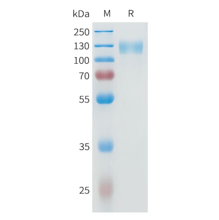 SDS-PAGE - Recombinant Human IL-31RA Protein (C-terminal mFc Tag) (A332950) - Antibodies.com