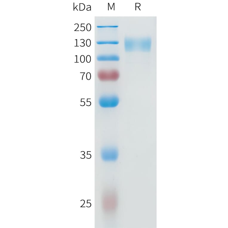 SDS-PAGE - Recombinant Human IL-31RA Protein (C-terminal mFc Tag) (A332950) - Antibodies.com