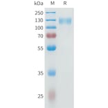 SDS-PAGE - Recombinant Human IL-31RA Protein (C-terminal mFc Tag) (A332950) - Antibodies.com